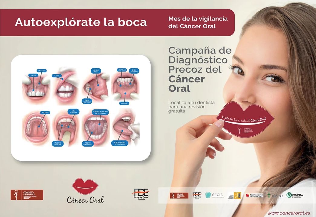 V Campaña de Prevención del Cáncer Oral