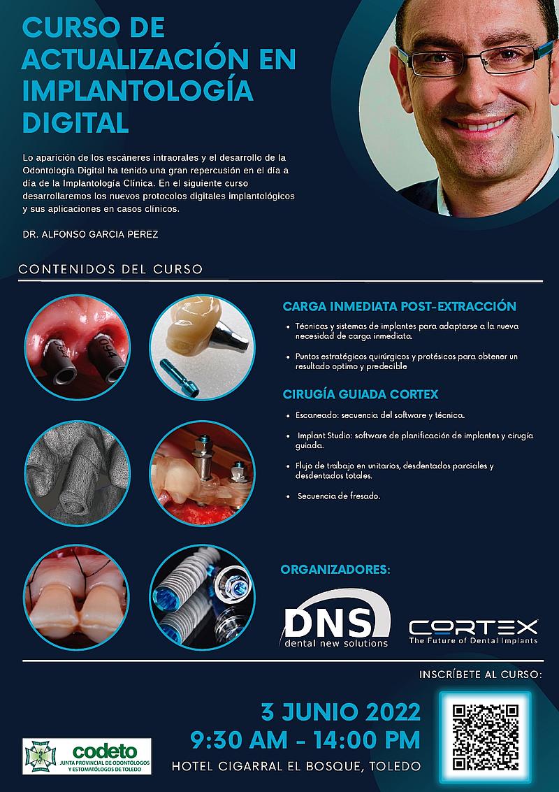 curso Actualización en Implantología Digital