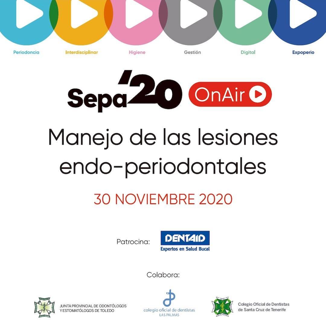 curso Manejo de las lesiones endo-periodontales en SEPA online